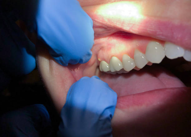 Best Emergency Dentist for Special Needs Patients in Whittier, CA