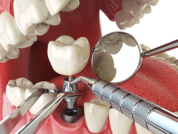Best Weekend Emergency Dentist in Whittier, CA
